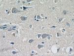 NF-H Antibody in Immunohistochemistry (Paraffin) (IHC (P))