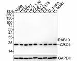 RAB10 Antibody in Western Blot (WB)