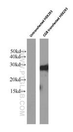 hCG beta Antibody in Western Blot (WB)