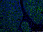 E-cadherin Antibody in Immunohistochemistry (PFA fixed) (IHC (PFA))