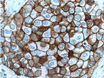 E-cadherin Antibody in Immunohistochemistry (Paraffin) (IHC (P))