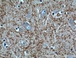 CX3CL1 Antibody in Immunohistochemistry (Paraffin) (IHC (P))