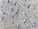 beta Amyloid Antibody in Immunohistochemistry (Paraffin) (IHC (P))