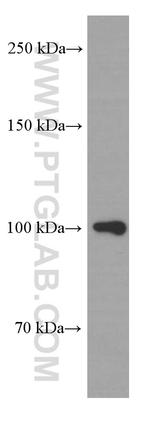 beta Amyloid Antibody in Western Blot (WB)