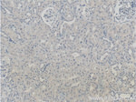 Prostein Antibody in Immunohistochemistry (Paraffin) (IHC (P))