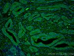 LIN28 Antibody in Immunohistochemistry (PFA fixed) (IHC (PFA))