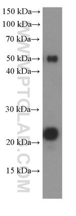 CD3 gamma Antibody in Western Blot (WB)