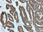 Cadherin-17 Antibody in Immunohistochemistry (Paraffin) (IHC (P))