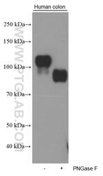 Cadherin-17 Antibody in Western Blot (WB)