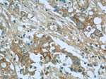 Cadherin-17 Antibody in Immunohistochemistry (Paraffin) (IHC (P))