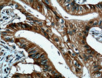 Cadherin-17 Antibody in Immunohistochemistry (Paraffin) (IHC (P))