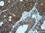 Cadherin-17 Antibody in Immunohistochemistry (Paraffin) (IHC (P))