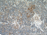 Cadherin-17 Antibody in Immunohistochemistry (Paraffin) (IHC (P))