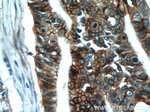 Cadherin-17 Antibody in Immunohistochemistry (Paraffin) (IHC (P))