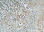 Cadherin-17 Antibody in Immunohistochemistry (Paraffin) (IHC (P))