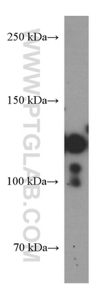 Cadherin-17 Antibody in Western Blot (WB)