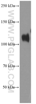 Cadherin-17 Antibody in Western Blot (WB)