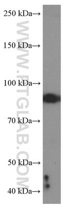 MUM1 Antibody in Western Blot (WB)