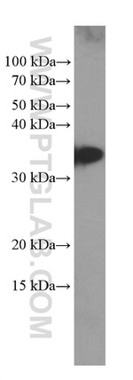 CD99 Antibody in Western Blot (WB)