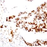 AID Antibody in Immunohistochemistry (Paraffin) (IHC (P))