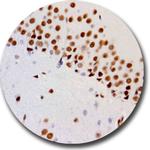 ATF2 Antibody in Immunohistochemistry (Paraffin) (IHC (P))