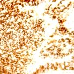 Aurora A Kinase Antibody in Immunohistochemistry (Paraffin) (IHC (P))