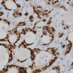 CDX2 Antibody in Immunohistochemistry (Paraffin) (IHC (P))