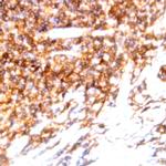 CD138 Antibody in Immunohistochemistry (Paraffin) (IHC (P))