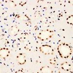 FANCD2 Antibody in Immunohistochemistry (Paraffin) (IHC (P))