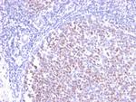 Bcl-6 Antibody in Immunohistochemistry (Paraffin) (IHC (P))
