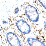CD94 Antibody in Immunohistochemistry (Paraffin) (IHC (P))