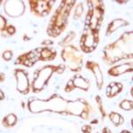 NKB1 Antibody in Immunohistochemistry (Paraffin) (IHC (P))