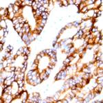 Claudin 5 Antibody in Immunohistochemistry (Paraffin) (IHC (P))