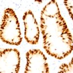 cyclin E Antibody in Immunohistochemistry (Paraffin) (IHC (P))