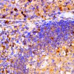 p59/FYN Antibody in Immunohistochemistry (Paraffin) (IHC (P))