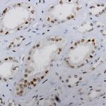 MALT-1 Antibody in Immunohistochemistry (Paraffin) (IHC (P))