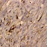 Notch-1 Antibody in Immunohistochemistry (Paraffin) (IHC (P))