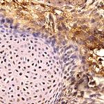 SOX-11 Antibody in Immunohistochemistry (Paraffin) (IHC (P))