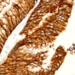 Telomerase Reverse Transcriptase (TERT) Antibody in Immunohistochemistry (Paraffin) (IHC (P))