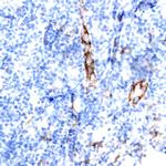 TSC1 (Hamartin) Antibody in Immunohistochemistry (Paraffin) (IHC (P))