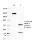 CD269/TNFRSF17/BCMA (B-Cell Maturation Protein) Antibody in SDS-PAGE (SDS-PAGE)