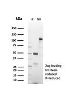 CD269/TNFRSF17/BCMA (B-Cell Maturation Protein) Antibody in SDS-PAGE (SDS-PAGE)
