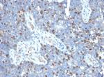 ROR-gamma/RORC (RAR-related Orphan Receptor C) Antibody in Immunohistochemistry (Paraffin) (IHC (P))