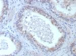 ROS1 Antibody in Immunohistochemistry (Paraffin) (IHC (P))