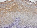 Desmoplakin 1/2 Antibody in Immunohistochemistry (IHC)