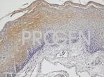 Desmoplakin 1/2 Antibody in Immunohistochemistry (IHC)