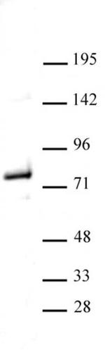 Menin Antibody in Western Blot (WB)