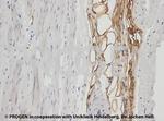 Adipophilin Antibody in Immunohistochemistry (IHC)