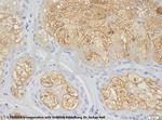 Adipophilin Antibody in Immunohistochemistry (IHC)