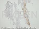 Adipophilin Antibody in Immunohistochemistry (IHC)